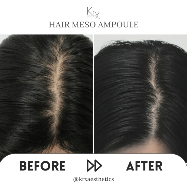 KrX Premium Hair Meso Solution – Bild 2